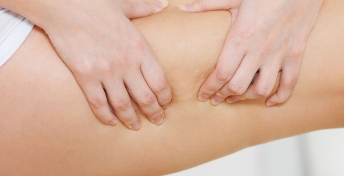 Zabiegi na cellulit - jetsetclinic.pl