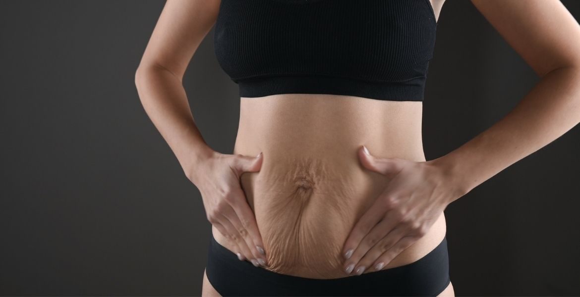 JETSET CLINIC HILTION brzuch po ciąży